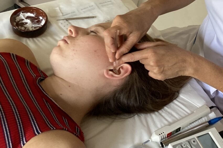 reflexologie-auriculaire